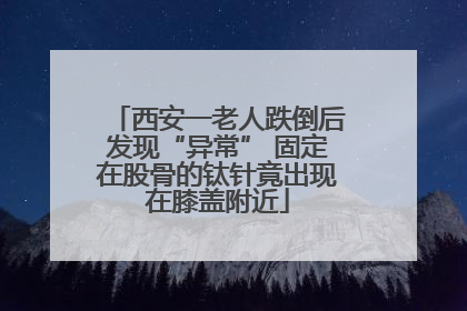 西安一老人跌倒后发现“异常” 固定在股骨的钛针竟出现在膝盖附近
